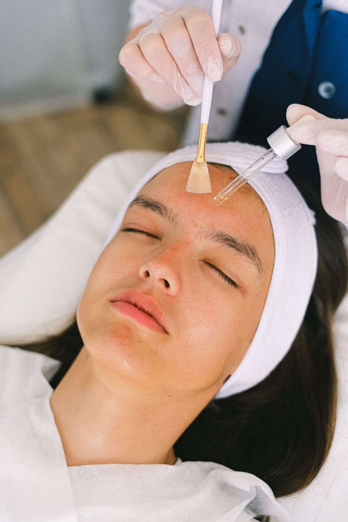 Chemical Peel Facial